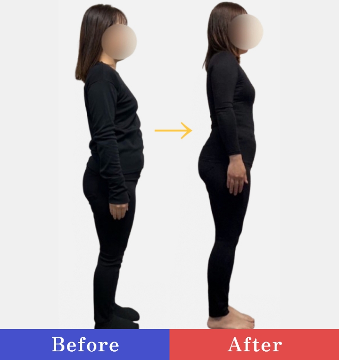 Before/After